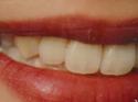 Bakal Denture Clinic